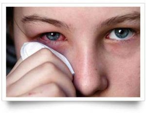 conjuntivitis_alergica