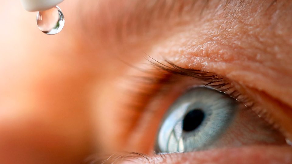 Ojo Seco Optica Baca Ronda