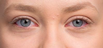 Infecciones que afectan a la salud visual. Óptica Baca SL