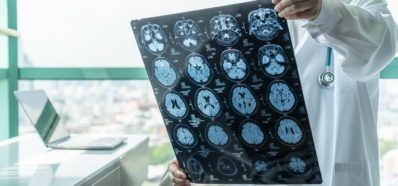 Encefalitis y salud visual. Óptica Baca Ronda